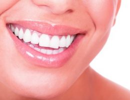 sourire-blanchiment